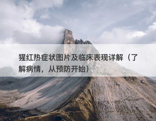 猩红热症状图片及临床表现详解（了解病情，从预防开始）