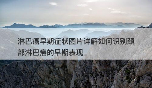 淋巴癌早期症状图片详解如何识别颈部淋巴癌的早期表现