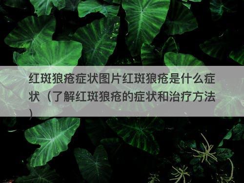 红斑狼疮症状图片红斑狼疮是什么症状（了解红斑狼疮的症状和治疗方法）
