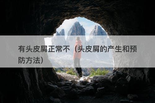 有头皮屑正常不（头皮屑的产生和预防方法）